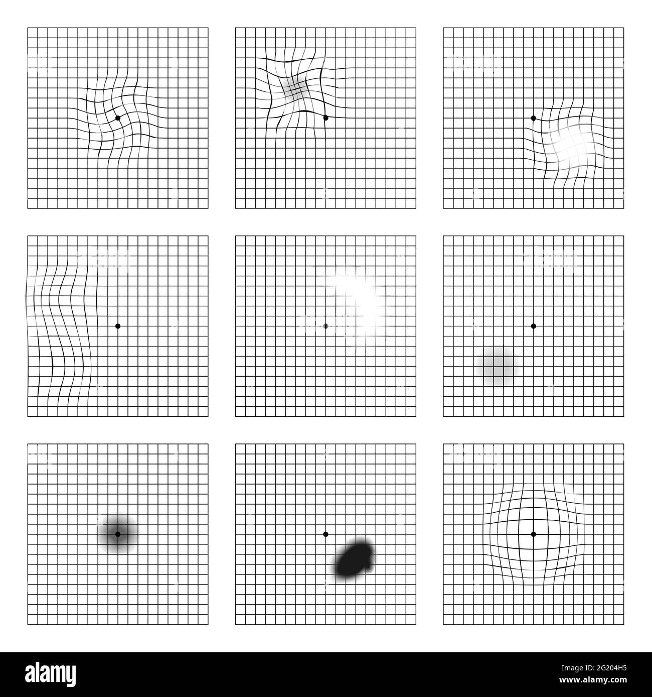 Amsler Grid Stock Vector Images - Alamy for Printable Macular Degeneration Eye Chart