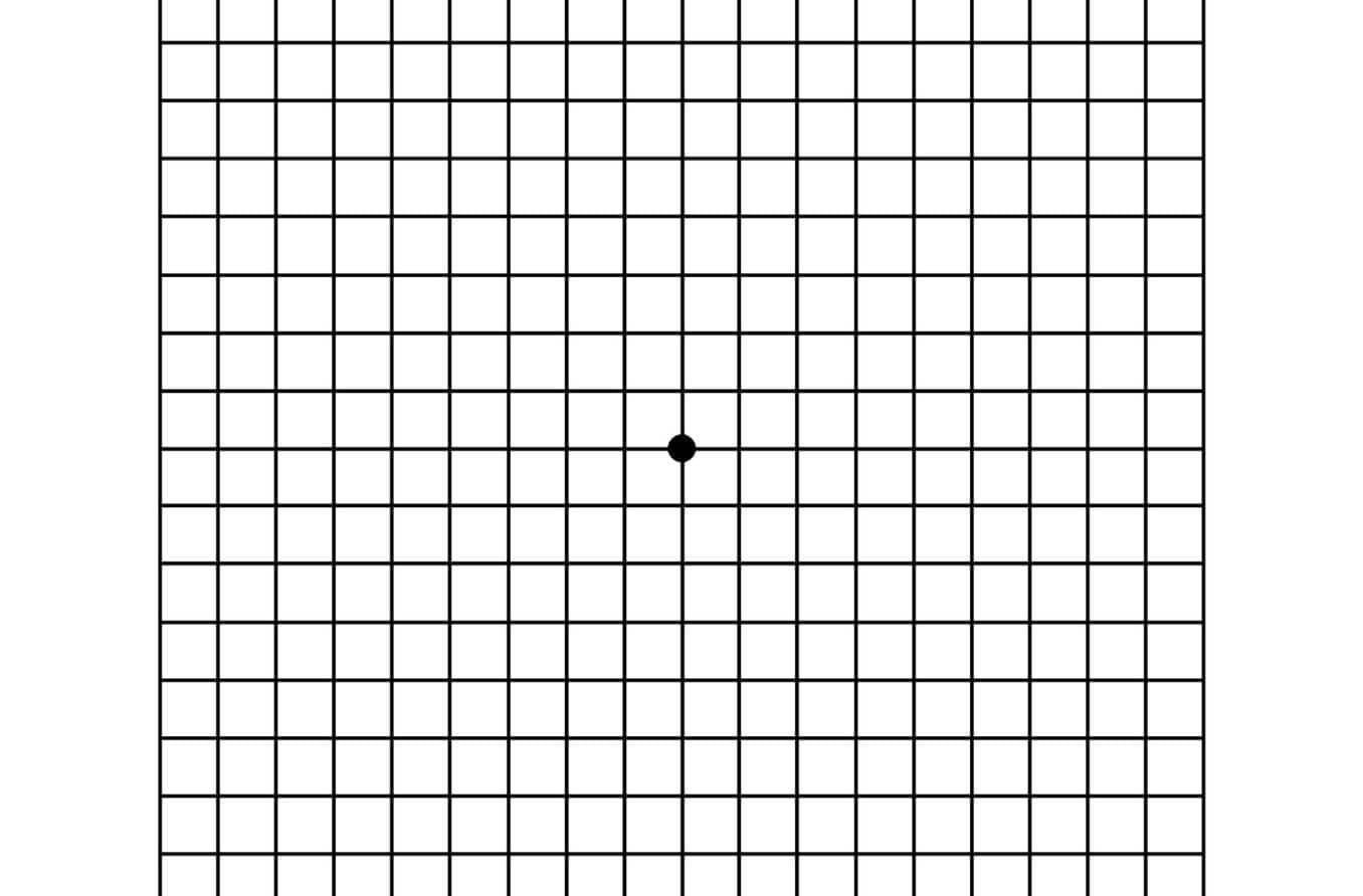 Macular Degeneration Test: How To Use The Amsler Grid within Printable Amsler Grid Eye Test Chart
