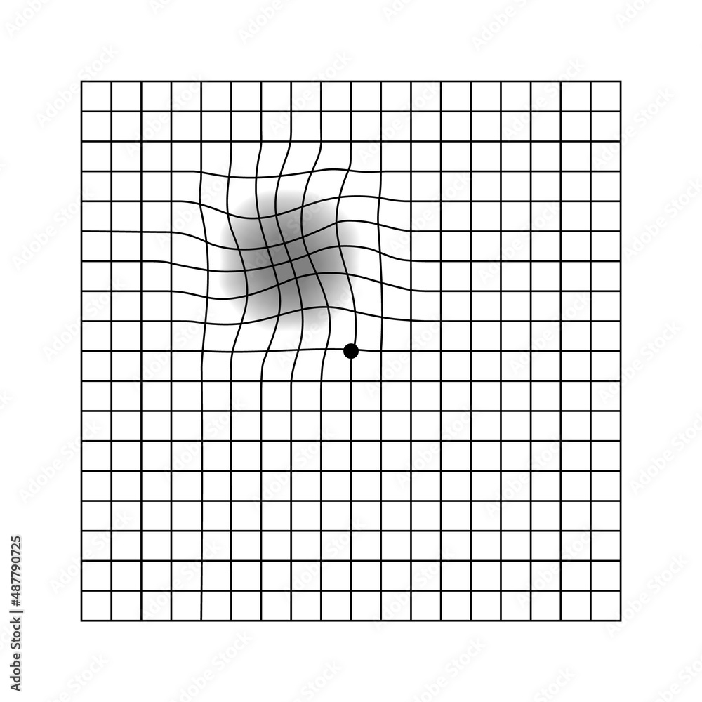 Stock-Vektorgrafik „Amsler Eye Scotoma Test Grid. Vector Printable with regard to Grid Eye Chart Printable