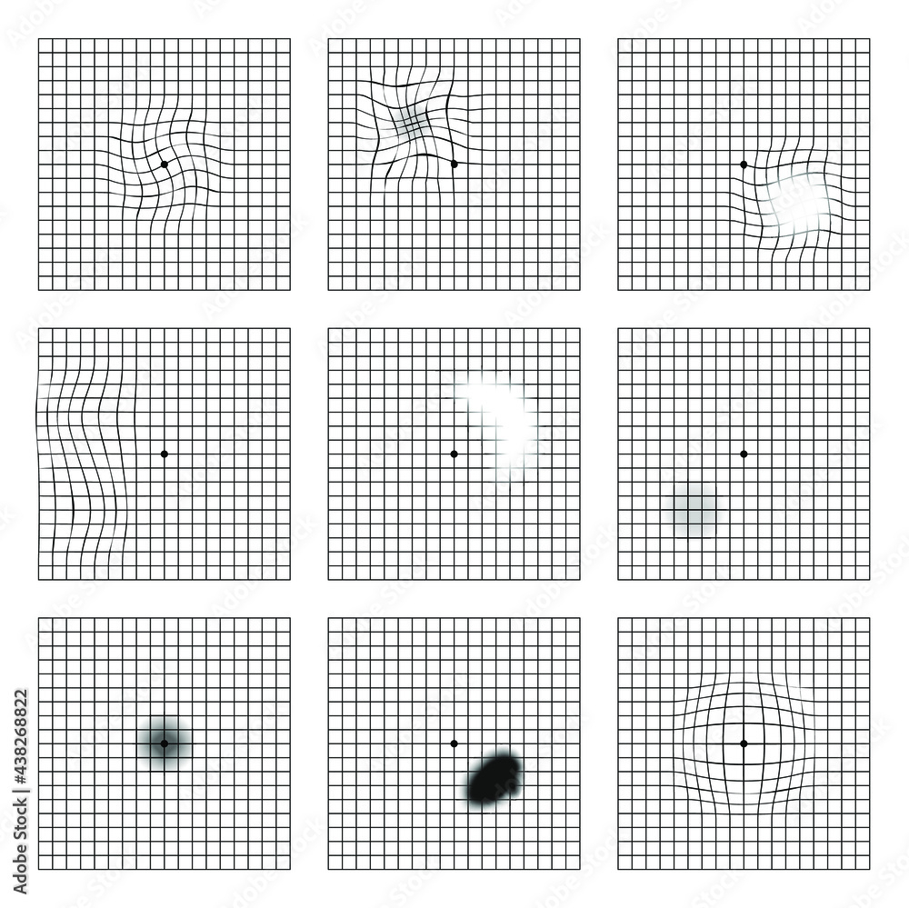 Stock-Vektorgrafik „Amsler Grid Scotoma Eye Test. Oculist Vector pertaining to Printable Dot Eye Chart