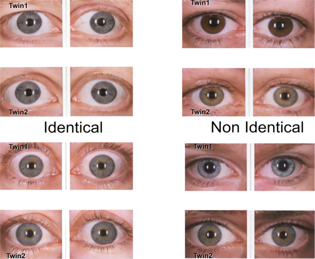 What Colour Are Your Eyes? Teaching The Genetics Of Eye Colour regarding Printable Eye Color Chart